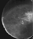 0_1611305_316409.gif