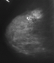 0_1611320_316409.gif