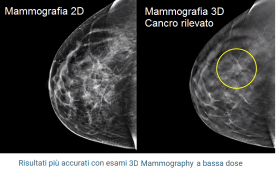 Tomosintesi - STUDIO MEDICO SENOLOGICO 