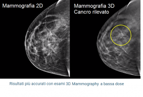 Rx  Mammografia Digitale - Studio Medico Cirolla